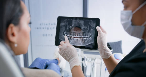 Licensed Dental Implants service in Fargo, ND - Smile Center Dentistry